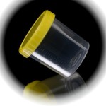 Контейнер для мочи, 100 мл нестерильный